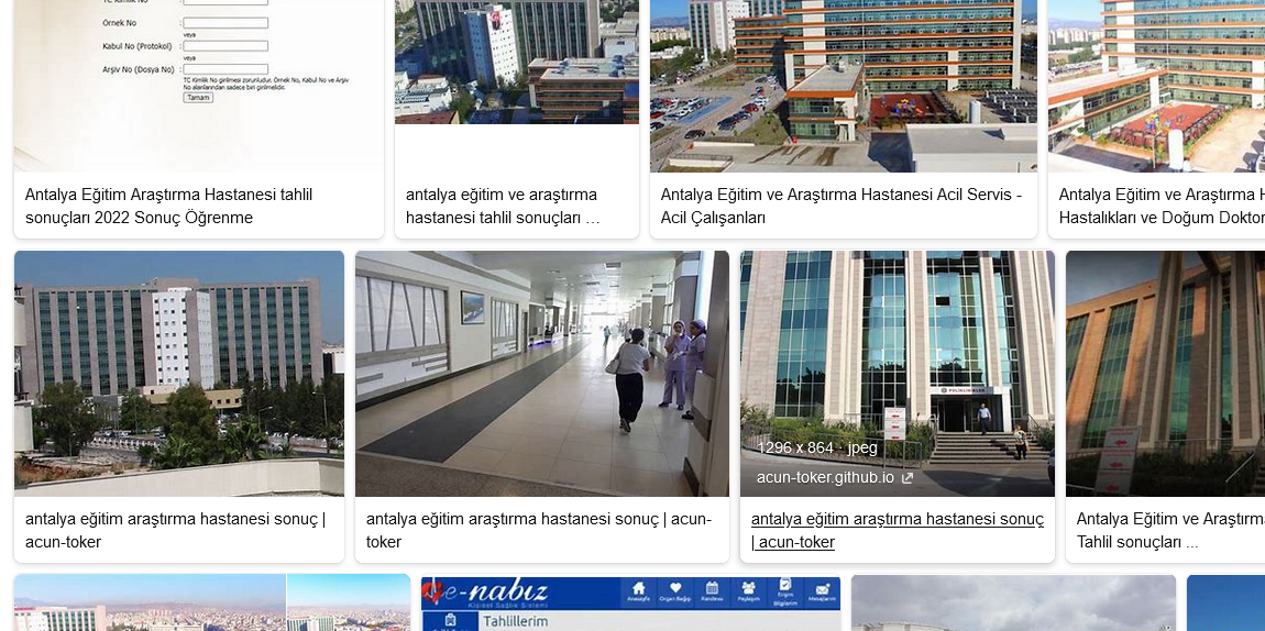 Antalya Eğitim Araştırma Hastanesi Tahlil Sonuçları
