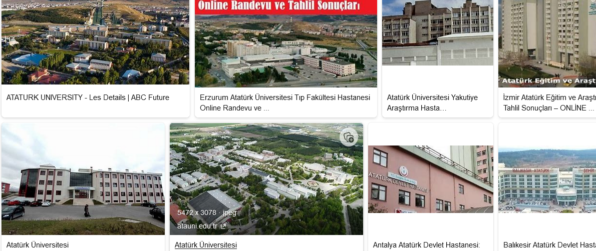 Atatürk Üniversitesi Tahlil Sonuçları
